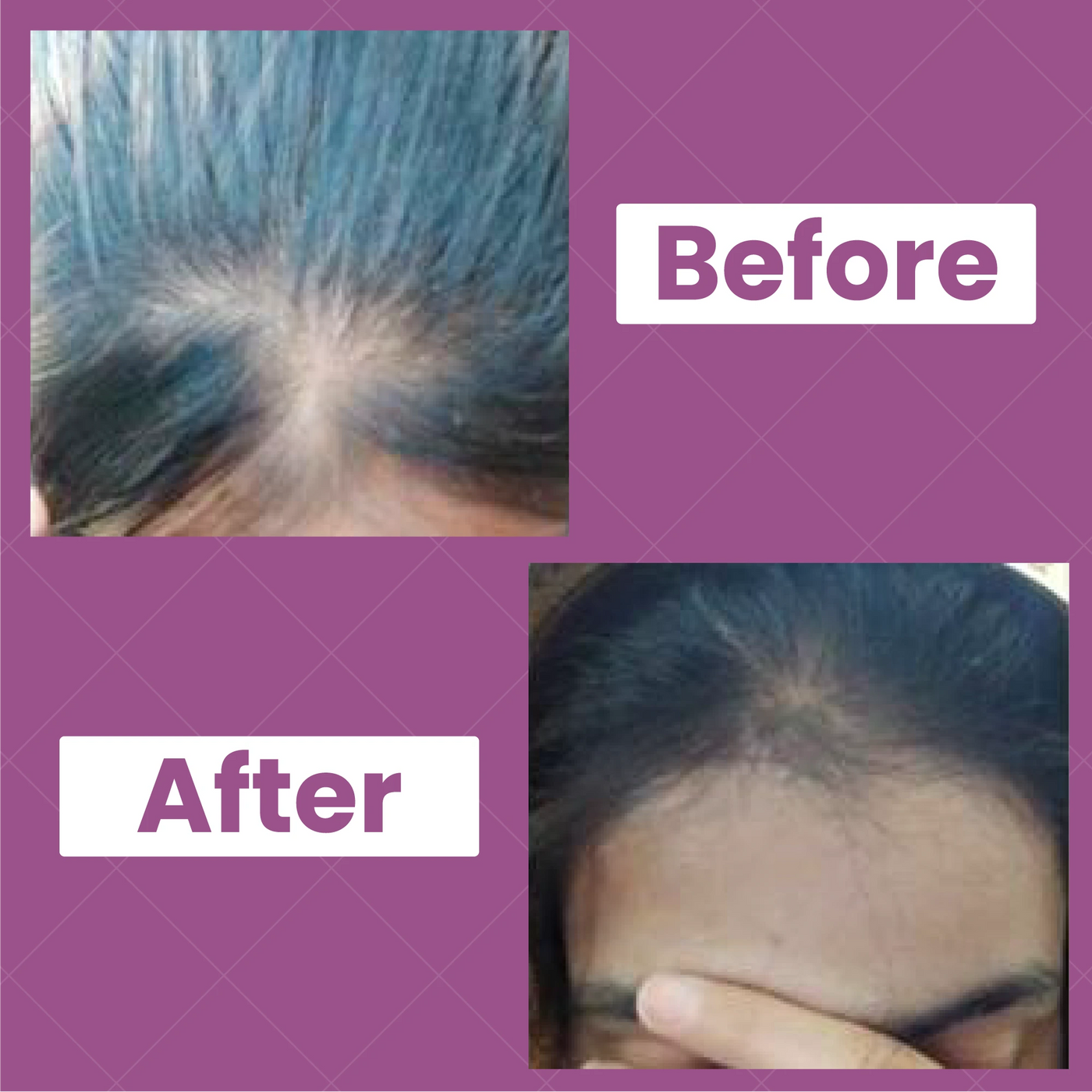 Hair Biotin Oil | Best Hair Oil For All Hair Related Problems